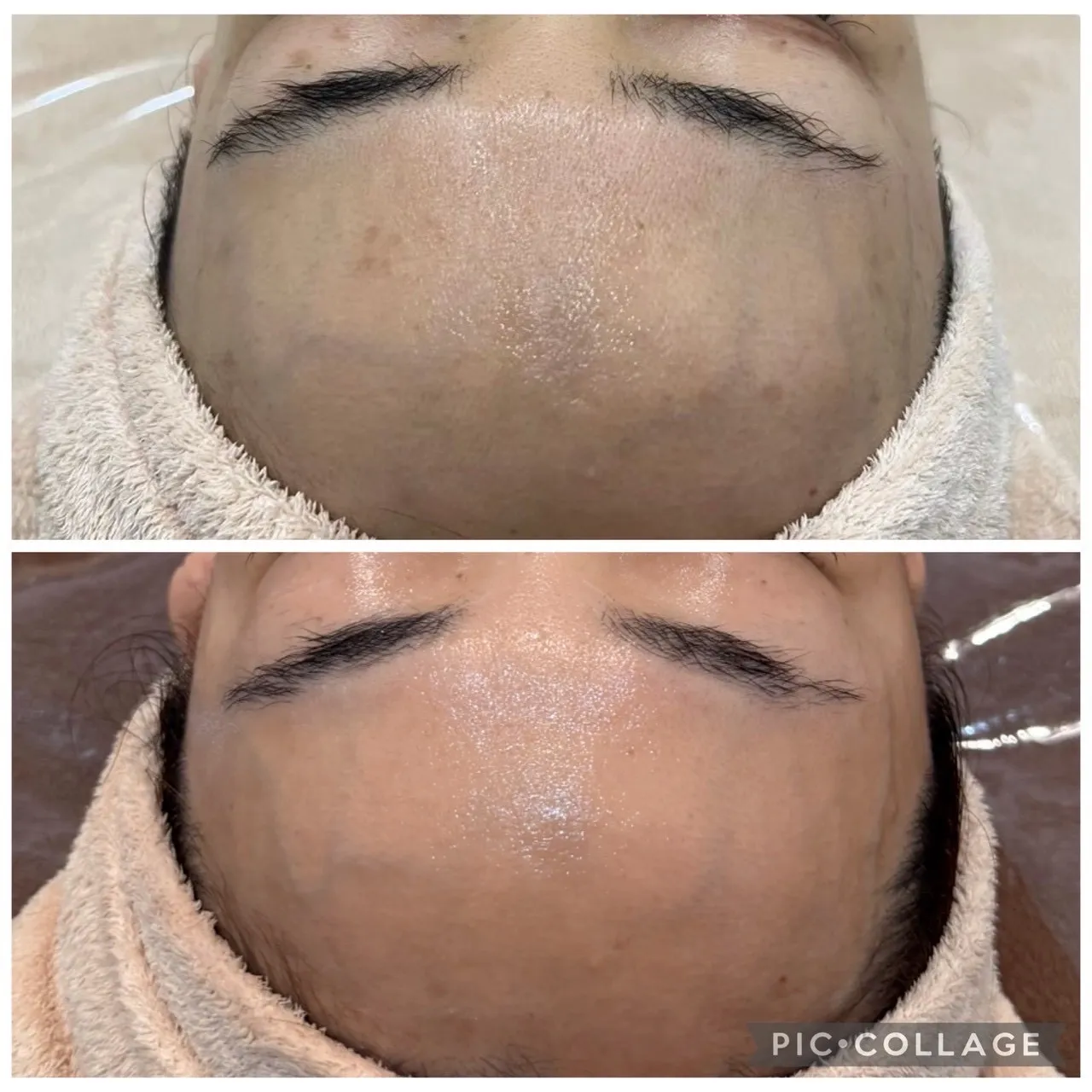 （尼崎肌質改善フェイシャルサロン）40代以降の肌悩みで増える「ハリ・弾力・くすみ」の原因と改善方法