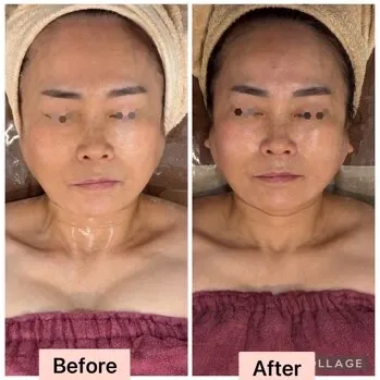   尼崎で小顔・左右差改善なら｜肌質改善・小顔｜JR尼崎駅徒歩2分Rindaリンダへ