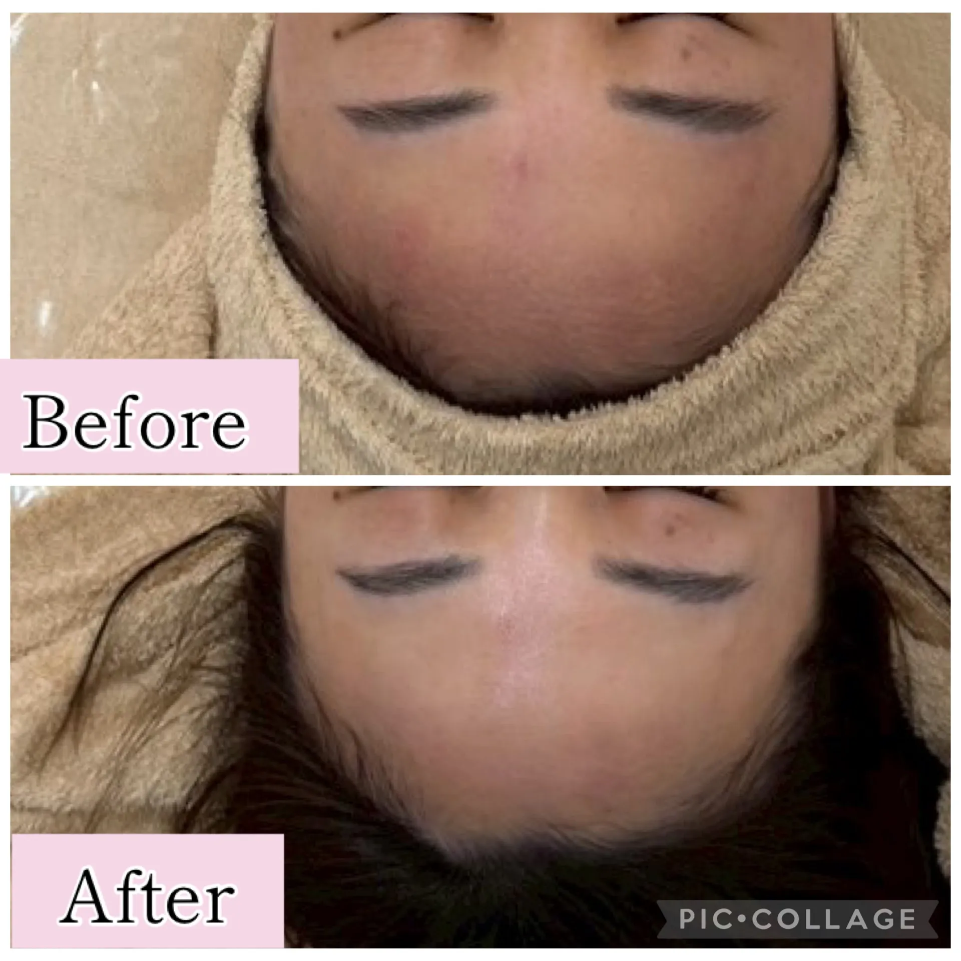 【尼崎】ごわつき・くすみ・赤み・敏感肌でお悩みの方へ｜肌質改善エステ BeautySalon Rinda