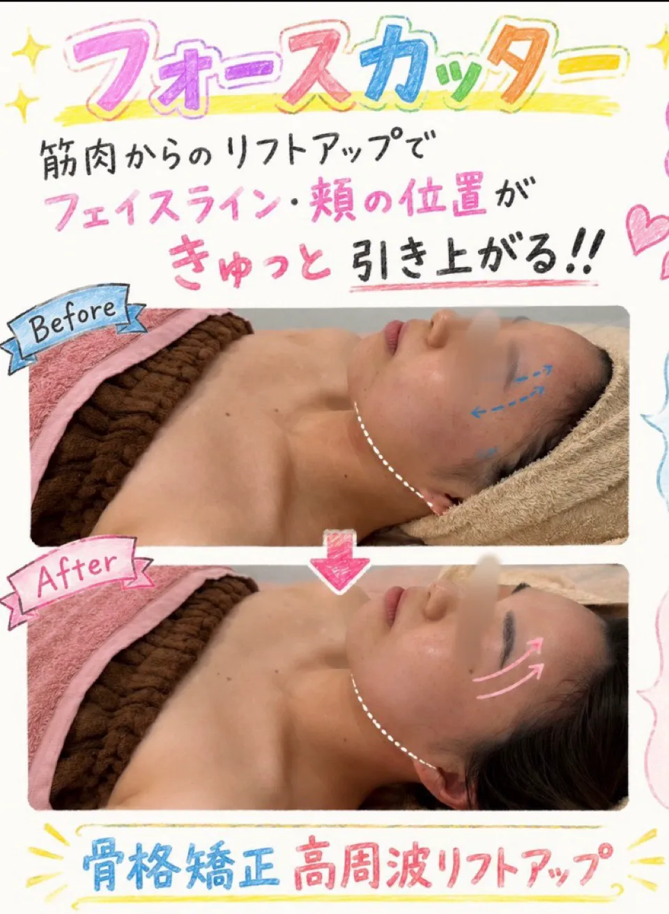    「最近老けた？」と感じたら。尼崎で始める本格リフトアップケア * 頬の位置が変わるだけで印象が変わる！尼崎の小顔・リフトアップエステ