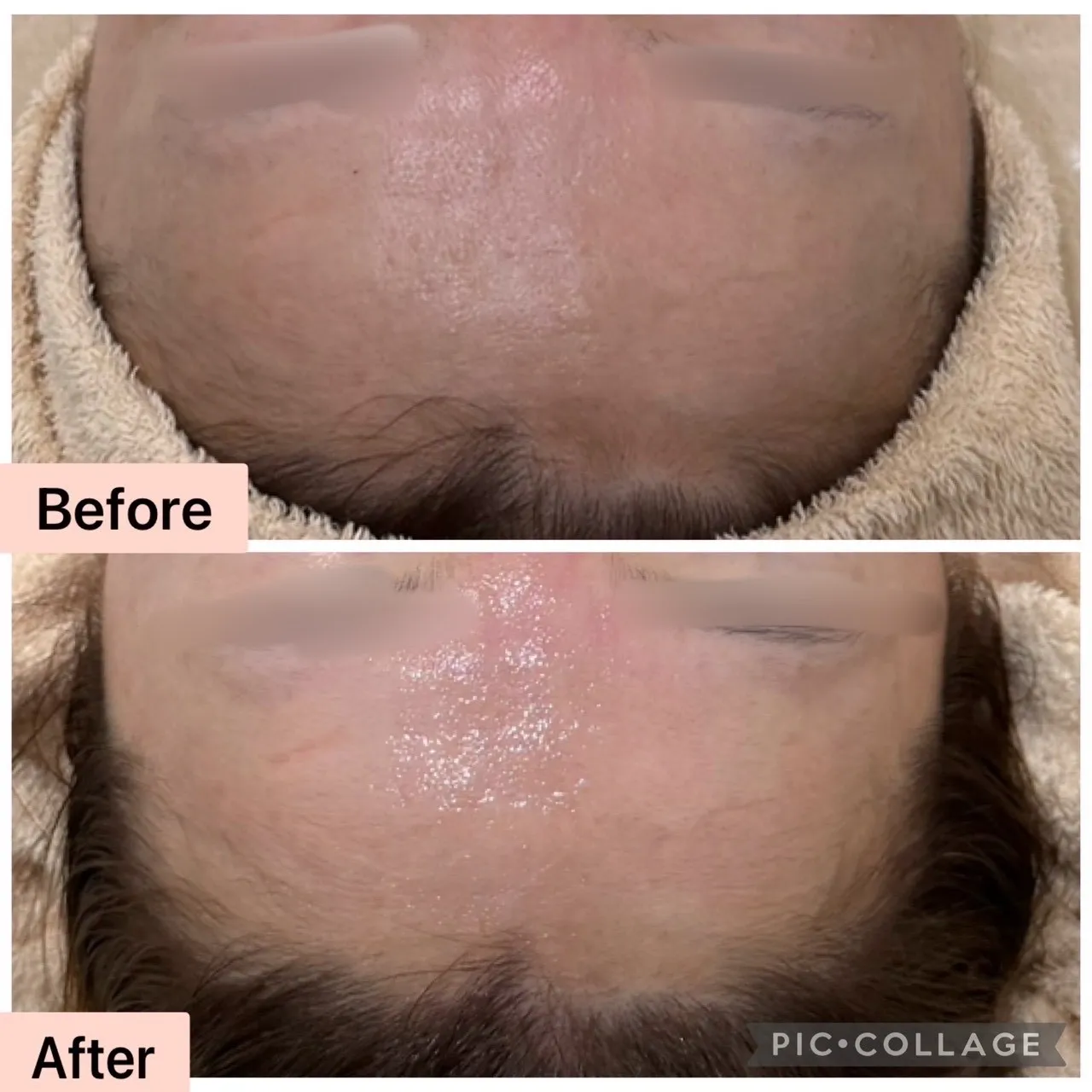 尼崎の肌質改善専門サロン｜赤み・敏感肌・ 毛穴・ニキビ改善なら Rinda Beauty Salonリンダビューティーサロン