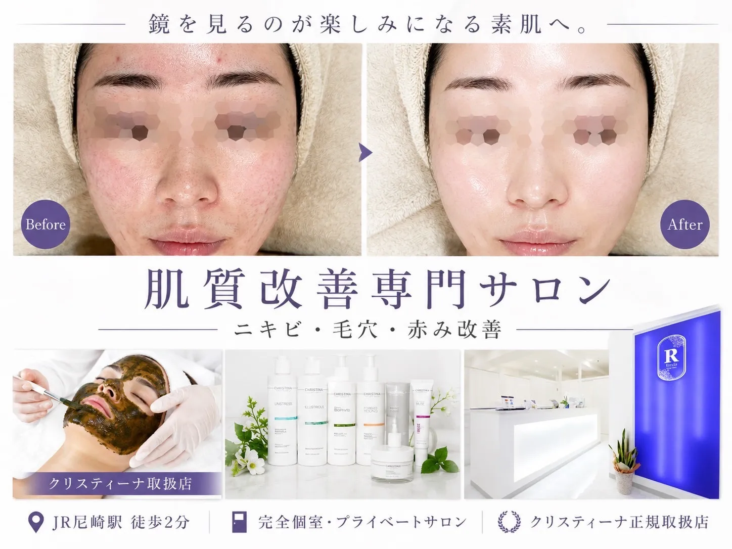 崎の肌質改善専門サロン｜赤み・敏感肌・ 毛穴・ニキビ改善なら Rinda Beauty Salon