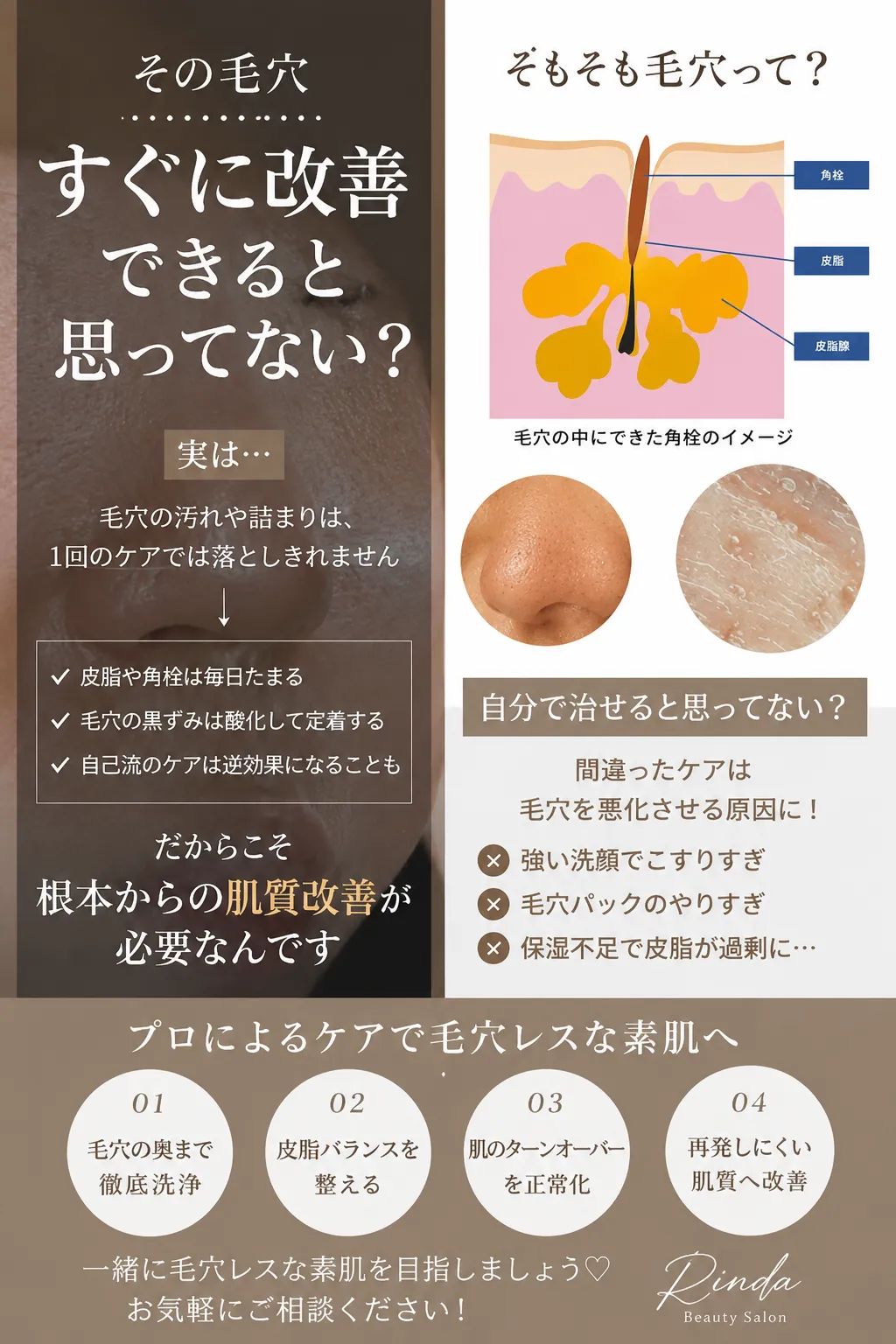 尼崎の肌質改善専門サロン｜赤み・敏感肌・ 毛穴・ニキビ改善なら Rinda Beauty Salonリンダビューティーサロンへ